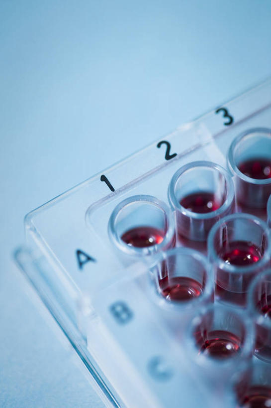 无人,竖图,俯视,室内,特写,白天,实验,静物,一排,许多,朦胧,模糊,研究,整齐,分析,化学,测试,英文,标志,数字,文字,液体,字符,塑料,字母,洞,很多,标识,架子,排列,红色,塑料制品,摄影,阿拉伯数字,洞穴,影棚,英文字母,样本,样品,队列,穴,试验耗材,实验用品,彩图,高角度拍摄,影棚拍摄,拍摄