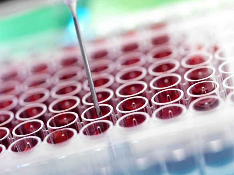 无人,横图,俯视,室内,特写,白天,实验,仪器,杯子,一排,许多,朦胧,模糊,研究,整齐,并列,并排,透明,分析,化学,测试,试管,试管架,液体,很多,架子,玻璃制品,排列,一个,红色,玻璃瓶,瓶子,搅拌棒,器皿,血液,摄影,影棚,单个,暖色,队列,平行,计量,玻璃仪器,试验耗材,实验用品,赤色,玻璃杯,搅棒,彩图,高角度拍摄,影棚拍摄,拍摄