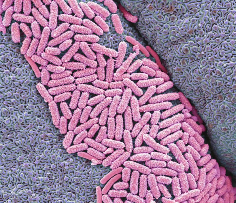 无人,横图,插画,室内,白天,正面,爱情,幸福,数码,科技,微生物,一堆,许多,阴影,堆叠,堆积,网络,细菌,纹路,纹理,粉红色,粉红,很多,高光,几何,计算机图形,浪漫,合成,图画,画,粉色,健康,可爱,活泼,青春,堆,满足,电脑合成图,数码合成图,甜美,合成图,时髦,温柔,漫画,纯真,肌理,写实,具体,具象,生命体,大肠杆菌,大肠埃希氏菌,肠道菌群,彩图