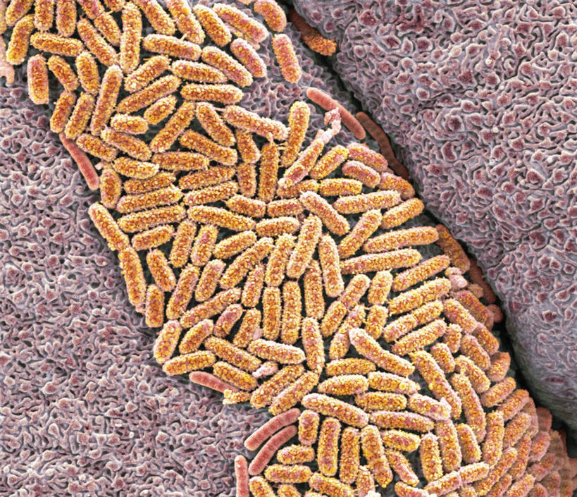 无人,横图,插画,室内,白天,正面,幸福,数码,科技,微生物,一堆,许多,阴影,堆叠,堆积,网络,细菌,纹路,纹理,很多,高光,几何,计算机图形,辉煌,合成,图画,画,温暖,橙色,活泼,堆,华丽,暖色,电脑合成图,数码合成图,合成图,漫画,温情,肌理,写实,具体,具象,生命体,大肠杆菌,大肠埃希氏菌,肠道菌群,炽热,响亮,跃动,甜蜜,彩图,愉快