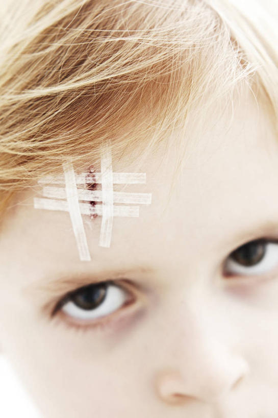 西方人,儿童,脸,头,脸颊,头发,一个人,交叉,竖图,俯视,室内,特写,白天,白色背景,纯洁,欧洲,欧洲人,仅一个男性,仅一个人,注视,小孩,医疗用品,观察,看,仅一个小孩,金色,可爱,童年,童趣,治疗,摄影,影棚,观看,察看,医疗,医疗设备,关注,胶布,童真,烂漫,无邪,相交,交集,止血,天真,男孩,男人,男性,白种人,孩子,头部,脸部,脸蛋,面部,绷带,创可贴,半身,彩图,高角度拍摄,影棚拍摄,拍摄,短发,男生