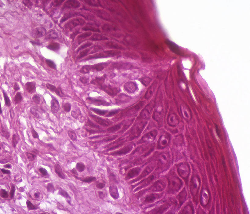 无人,横图,室内,特写,白天,白色背景,正面,爱情,幸福,仪器,静物,检查,反射,分析,科学,医学,显微镜,粉红色,粉红,浪漫,粉色,观察,健康,可爱,清晰,探索,人体,摄影,活泼,影棚,放大,观看,青春,满足,仔细,透镜,甜美,生物学,人体器官,凸透镜,聚焦,器官,关注,时髦,温柔,纯真,光学,清楚,味觉器官,显微图片,自然科学,博物学,生物科学,味蕾,彩图,影棚拍摄,拍摄,舌乳头,味觉感受器