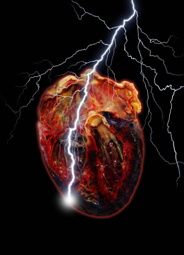 内脏,心脏,动脉,静脉,无人,竖图,插画,室内,白天,正面,数码,科技,闪电,阴影,飞溅,黑色背景,溅,科学,网络,医学,火花,高光,几何,计算机图形,合成,图画,画,人体,电脑合成图,数码合成图,生物学,人体器官,器官,合成图,喷洒,打雷,雷,漫画,心血管,心房,心室,写实,具体,具象,自然科学,博物学,生物科学,心,打闪,彩图