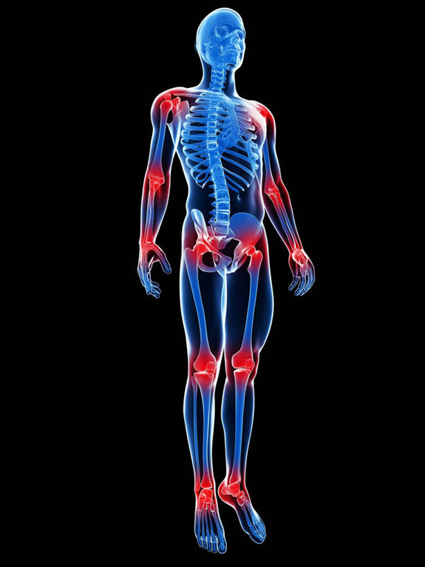 骨骼,关节,一个人,无人,站,竖图,插画,室内,白天,正面,数码,科技,仅一个男性,仅一个人,阴影,黑色背景,网络,骨头,高光,几何,计算机图形,合成,图画,画,仅一个年轻男性,红色,蓝色,站着,电脑合成图,数码合成图,骨架,疾病,合成图,漫画,写实,具体,具象,关节炎,男人,男性,年轻男性,站立,彩图,全身,肩关节周围炎,肩周炎,凝肩,五十肩