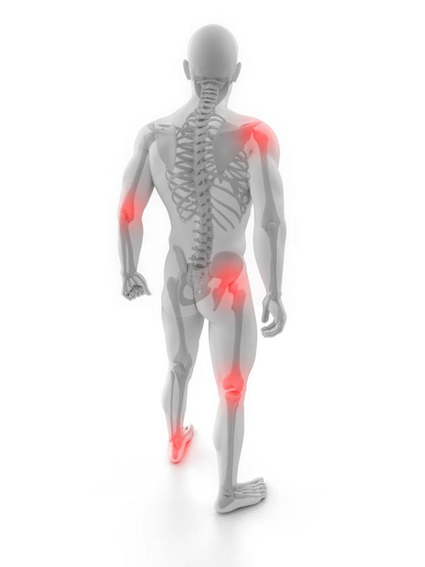 骨骼,关节,一个人,无人,站,竖图,插画,室内,白天,白色背景,数码,科技,仅一个男性,仅一个人,阴影,网络,骨头,高光,几何,计算机图形,合成,图画,画,仅一个年轻男性,背面,红色,灰色,站着,电脑合成图,数码合成图,骨架,疾病,合成图,漫画,写实,具体,具象,炎症,关节炎,男人,男性,年轻男性,站立,彩图,全身,发炎,肩关节周围炎,肩周炎,凝肩,五十肩