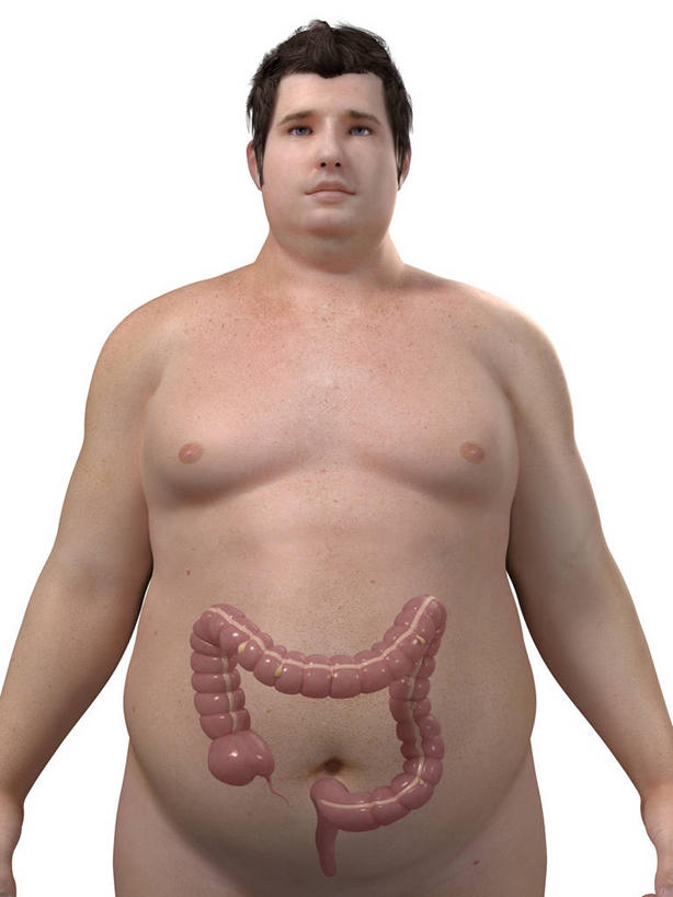 西方人,内脏,肠,动脉,静脉,肥胖,一个人,无人,站,竖图,插画,室内,白天,白色背景,正面,数码,科技,欧洲,欧洲人,仅一个男性,仅一个人,阴影,科学,网络,医学,高光,几何,计算机图形,合成,图画,注视,裸露,画,仅一个年轻男性,观察,看,站着,人体,赤裸,观看,电脑合成图,数码合成图,察看,生物学,人体器官,器官,合成图,关注,裸,漫画,写实,具体,具象,肥,胖,结肠,自然科学,博物学,生物科学,男人,男性,年轻男性,白种人,站立,半身,彩图