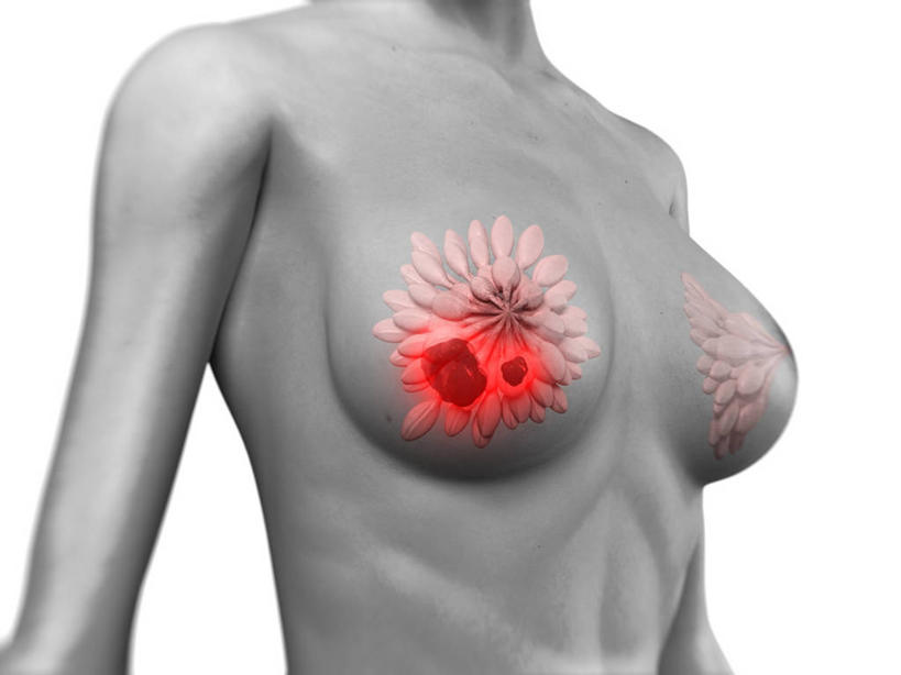 乳房,内脏,动脉,静脉,一个人,无人,站,横图,插画,室内,白天,白色背景,正面,数码,科技,仅一个年轻女性,仅一个女性,仅一个人,阴影,科学,网络,医学,高光,几何,计算机图形,合成,图画,裸露,画,灰色,站着,人体,赤裸,电脑合成图,数码合成图,生物学,人体器官,器官,合成图,裸,乳腺癌,漫画,癌症,癌细胞,写实,具体,具象,乳腺,自然科学,博物学,生物科学,年轻女性,女人,女性,站立,半身,彩图