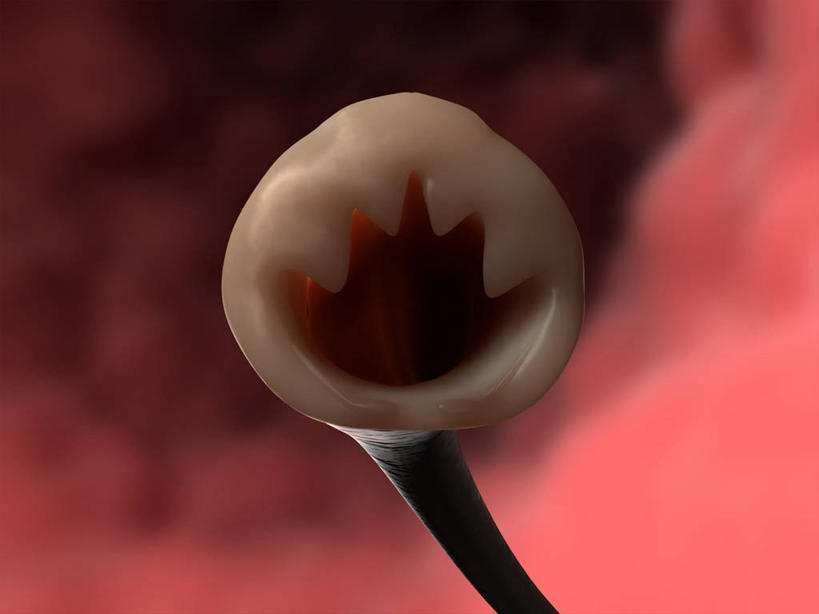 无人,横图,插画,室内,特写,白天,正面,数码,科技,阴影,红色背景,网络,洞,高光,几何,计算机图形,合成,图画,无脊椎动物,画,动物,洞穴,电脑合成图,数码合成图,合成图,漫画,穴,写实,具体,具象,寄生,寄生虫,蠕虫,蛔虫,线虫,彩图,肠道寄生虫