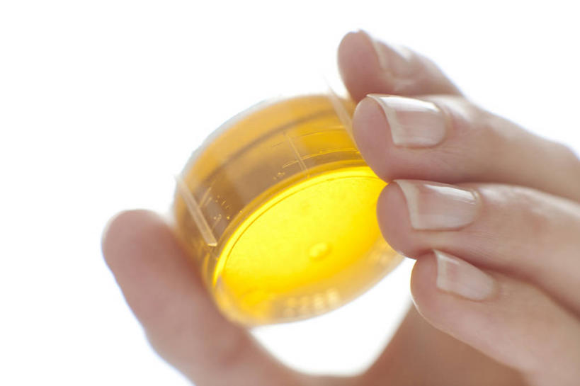 西方人,手,一个人,横图,室内,特写,白天,白色背景,仰视,安全,杯子,欧洲,欧洲人,仅一个女性,仅一个人,握,朦胧,模糊,药剂,塑料,防护,拿,拿着,黄色,塑料制品,药品,仅一个中年女性,手部,治疗,握着,摄影,影棚,塑料杯,保护,单手,药物,医疗,保险,预防,平安,女人,女性,中年女性,白种人,半身,彩图,低角度拍摄,影棚拍摄,拍摄,咳嗽糖浆,咳嗽药