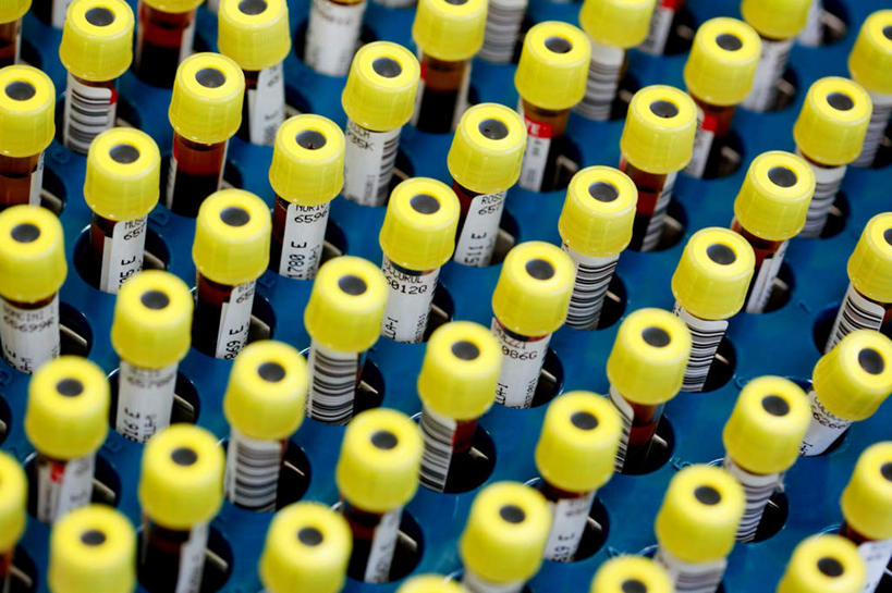 无人,横图,俯视,室内,白天,实验,仪器,水,杯子,一排,研究,整齐,透明,分析,化学,测试,试管,试剂,药剂,液体,水滴,玻璃制品,排列,玻璃瓶,瓶子,器皿,队列,计量,玻璃仪器,试验耗材,实验用品,玻璃杯,彩图,高角度拍摄