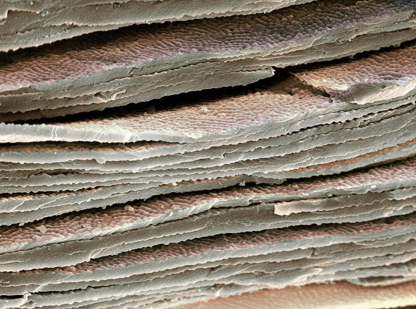 无人,横图,插画,室内,白天,正面,数码,科技,微生物,阴影,网络,医学,细胞,高光,几何,计算机图形,合成,图画,画,电脑合成图,数码合成图,医疗,生物学,眼球,漫画,写实,具体,具象,上皮细胞,电镜,彩图,扫描电镜,晶状体