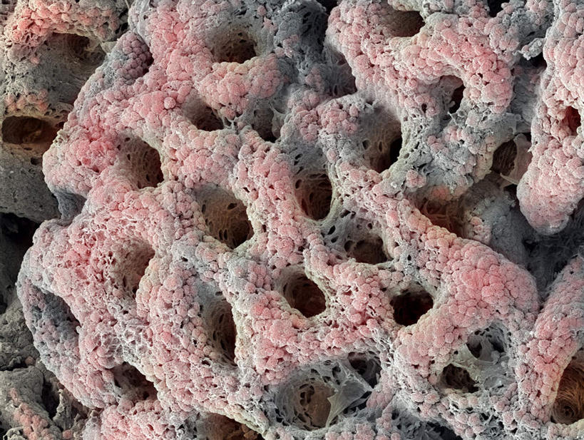 腹部,内脏,胃,动脉,静脉,无人,横图,插画,x光片,室内,白天,正面,数码,科技,静物,阴影,辐射,科学,网络,医学,高光,几何,计算机图形,合成,图画,画,模型,人体,电脑合成图,数码合成图,医疗,生物学,人体器官,科学技术,x射线,器官,x光,漫画,生理学,写实,具体,具象,胃壁,胃部,彩图,电磁波,电磁辐射