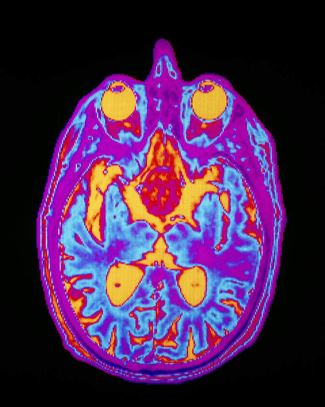 无人,竖图,插画,室内,白天,正面,数码,科技,阴影,黑色背景,网络,医学,高光,几何,计算机图形,合成,图画,画,一个,红色,生物,单个,电脑合成图,数码合成图,医疗,生物学,漫画,生理学,写实,具体,具象,脑垂体,彩图,垂体瘤,腺瘤