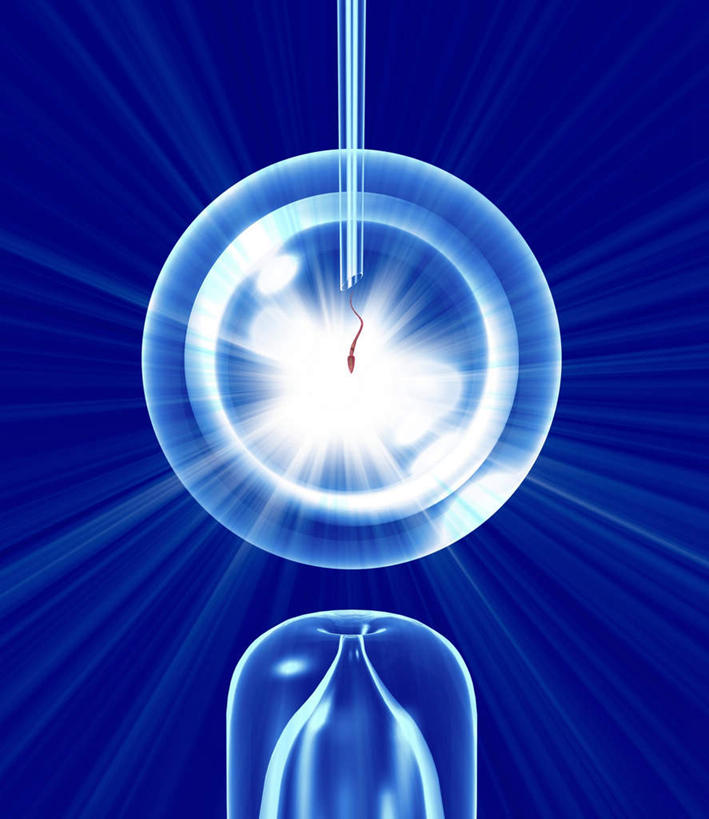 无人,竖图,插画,室内,白天,正面,数码,科技,阴影,发光,科学,网络,医学,圆形,高光,几何,计算机图形,合成,图画,画,蓝色,怀孕,电脑合成图,数码合成图,医疗,科学技术,人工受精,漫画,试管婴儿,写实,具体,具象,彩图,体外受精,体外受孕