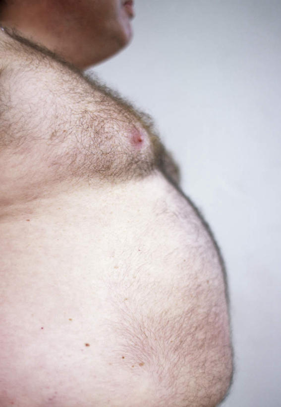 西方人,胸,腹部,肥胖,一个人,竖图,室内,特写,白天,白色背景,仰视,欧洲,欧洲人,仅一个男性,仅一个人,仅一个中年男性,许多,毛,墙,墙壁,墙面,摄影,影棚,体毛,肥,胖,男人,男性,中年男性,白种人,腹,肚子,胸部,半身,彩图,低角度拍摄,影棚拍摄,拍摄