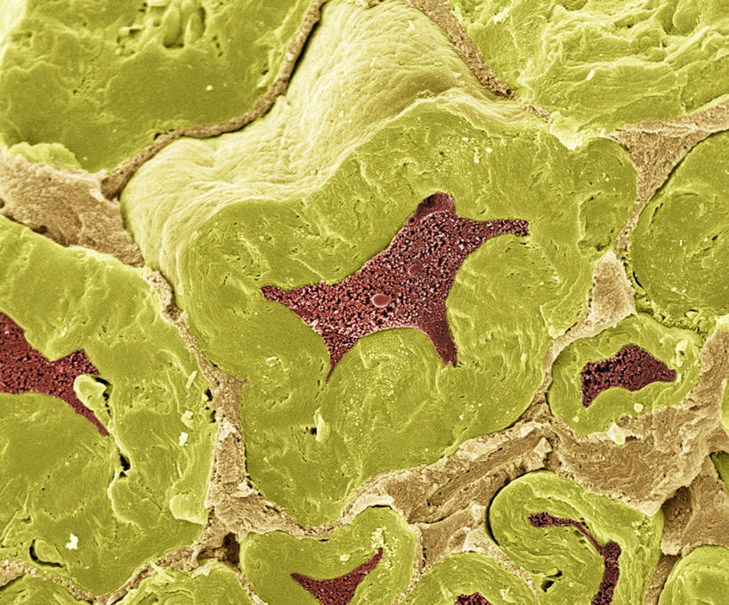 无人,横图,插画,室内,特写,白天,正面,数码,科技,静物,阴影,网络,血球,医学,细胞,高光,几何,计算机图形,合成,图画,画,蓝色,人体,电脑合成图,数码合成图,生物学,血细胞,横截面,漫画,生理学,写实,具体,具象,神经细胞,中枢神经系统,彩图