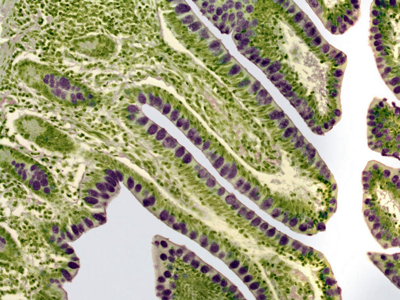 无人,横图,插画,室内,特写,白天,白色背景,正面,数码,科技,静物,阴影,网络,医学,细胞,高光,几何,计算机图形,合成,图画,画,人体,电脑合成图,数码合成图,生物学,漫画,生理学,写实,具体,具象,结肠癌,彩图