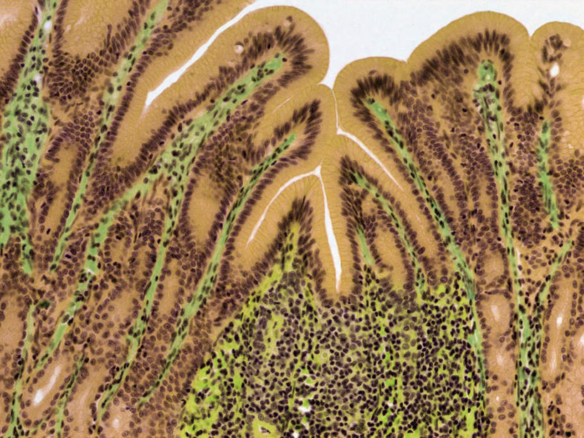 无人,横图,插画,室内,特写,白天,白色背景,正面,数码,科技,阴影,网络,高光,几何,计算机图形,合成,图画,画,电脑合成图,数码合成图,漫画,写实,具体,具象,淋巴系统,淋巴细胞,胃壁,淋巴,淋巴管,淋巴液,淋巴组织,免疫系统,免疫组织,彩图