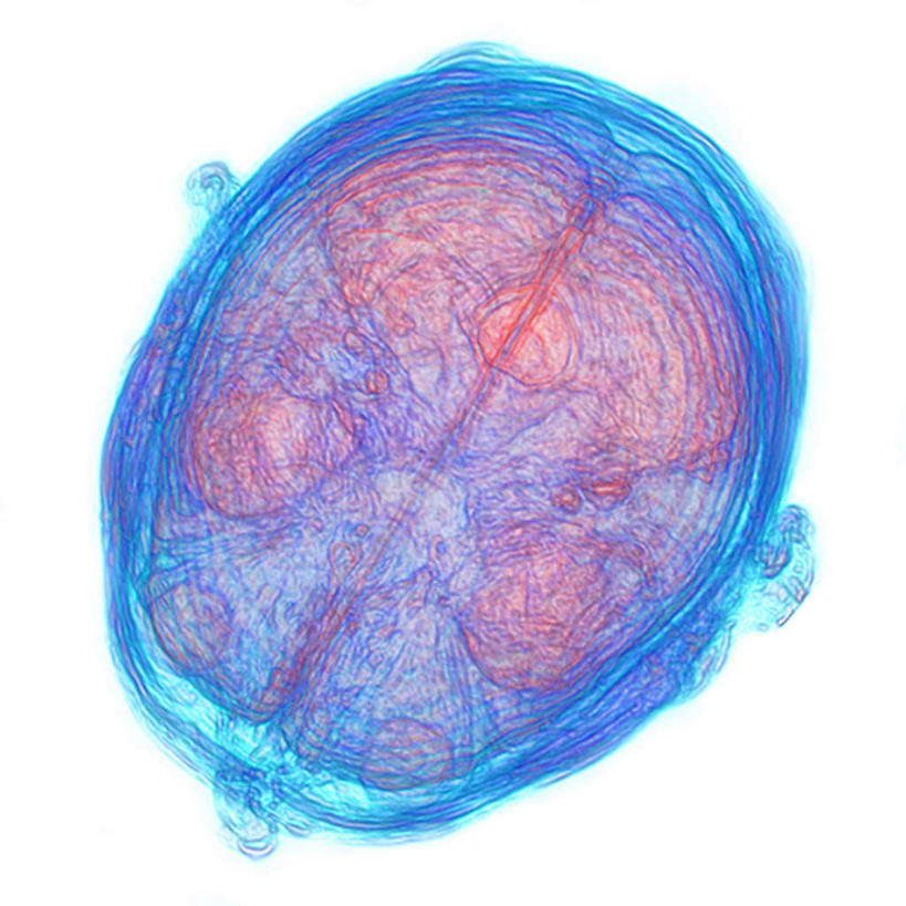 动脉,静脉,无人,交叉,竖图,室内,特写,白天,白色背景,正面,数码,科技,静物,大脑,连接,阴影,网状,组合,网络,医学,网,高光,几何,计算机图形,合成,交错,模型,人体,链接,交织,电脑合成图,数码合成图,生物学,人体器官,器官,拼接,拼凑,沟壑,小脑,脑干,生理学,写实,具体,具象,拼合,凑集,聚合,撮合,链结,大脑皮层,端脑,沟,灰质,回,间脑,解剖学,彩图