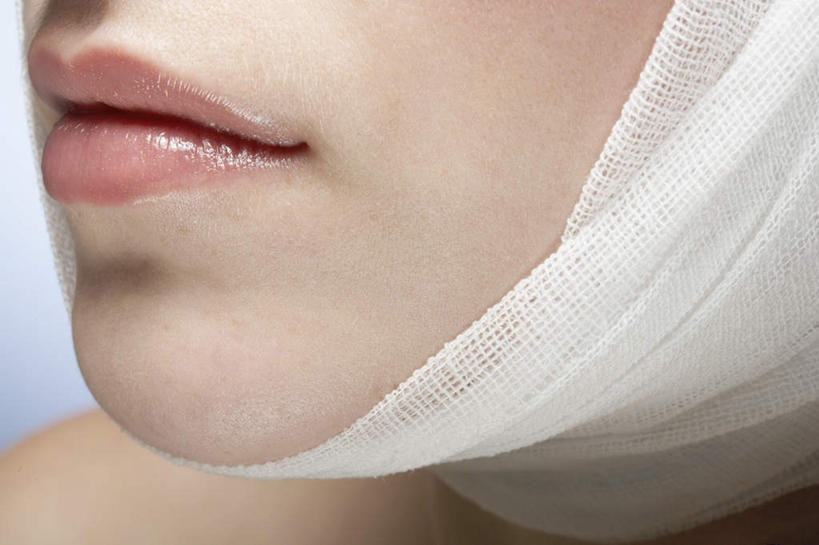 西方人,脸,头,嘴,脸颊,一个人,笑,微笑,横图,室内,特写,白天,正面,欧洲,欧洲人,仅一个年轻女性,仅一个女性,仅一个人,缠绕,肩膀,白色,摄影,影棚,包扎,受伤,年轻女性,女人,女性,白种人,头部,口,口腔,脸部,脸蛋,面部,嘴巴,嘴唇,绷带,半身,彩图,影棚拍摄,拍摄