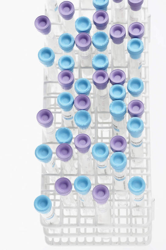 无人,竖图,俯视,室内,特写,白天,白色背景,实验,桌面,桌子,静物,一排,许多,阴影,研究,整齐,反射,分析,化学,测试,试管,试管架,影子,架子,排列,蓝色,紫色,摄影,影棚,队列,试验耗材,实验用品,彩图,高角度拍摄,影棚拍摄,拍摄