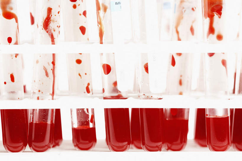 无人,横图,室内,特写,白天,白色背景,正面,实验,一排,许多,研究,整齐,分析,化学,血,测试,试管,试管架,液体,架子,排列,红色,摄影,影棚,队列,试验耗材,实验用品,彩图,影棚拍摄,拍摄