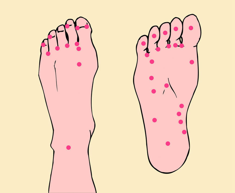 腿部,脚,脚趾,脚趾甲,腿,一个人,无人,横图,插画,室内,白天,正面,数码,科技,仅一个人,许多,阴影,黄色背景,网络,医学,斑点,高光,几何,计算机图形,合成,图画,画,红色,经络,经脉,脉络,电脑合成图,数码合成图,医疗,穴位,漫画,写实,具体,具象,腧穴,脚指甲,半身,彩图