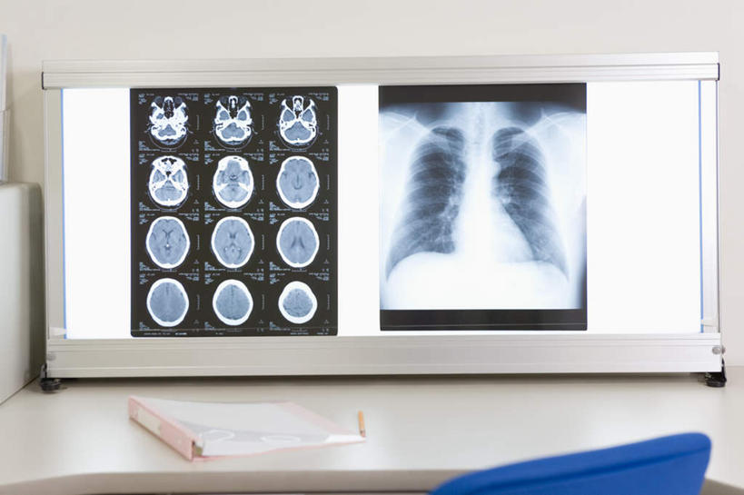 无人,医院,横图,x光片,室内,特写,白天,正面,桌子,静物,照明,检查,辐射,科学,医学,材料,档案,文件,办公桌,灯光,灯,资料,灯具,观察,灯箱,照亮,医疗,医疗设备,科学技术,x射线,照明设备,文档,医疗器械,x光,医疗机构,看片灯箱,彩图,病院,诊所,电磁波,电磁辐射