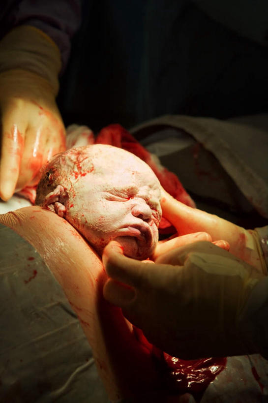 西方人,婴儿,儿童,脸,头,脸颊,四个人,医生,竖图,室内,特写,白天,正面,纯洁,安全,欧洲,欧洲人,阴影,光线,影子,灯光,防护,小孩,手套,医护人员,医疗人员,可爱,活泼,保护,分娩,宝宝,保险,纯真,烂漫,无邪,保全,周全,安稳,安定,防护手套,临盆,临蓐,伶俐,平安,天真,白种人,孩子,头部,脸部,脸蛋,面部,大夫,半身,彩图