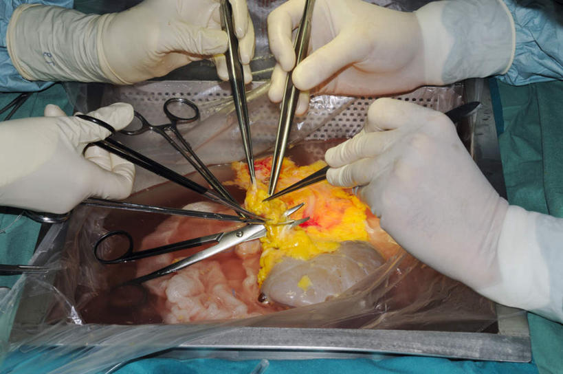 西方人,手,内脏,肠,肾脏,动脉,静脉,十二指肠,两个人,医院,横图,俯视,室内,白天,静物,欧洲,欧洲人,握,修剪,阴影,光线,医学,工具,剪刀,镊子,影子,塑胶,灯光,拿,拿着,模型,手部,握着,人体,裁剪,生物学,人体器官,剪子,解剖,剪裁,切割,器官,医疗机构,生理学,男人,男性,年轻男性,白种人,大肠,盲肠,小肠,直肠,半身,彩图,高角度拍摄,病院,诊所,剖解