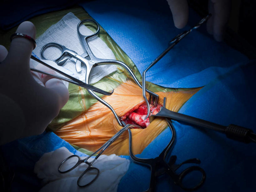 西方人,两个人,医生,站,躺,横图,室内,白天,正面,欧洲,欧洲人,锐利,刀具,刀,站着,医护人员,医疗人员,手术,锋利,手术刀,尖锐,医疗器械,尖利,犀利,厉害,医疗用具,男人,男性,年轻男性,年轻女性,女人,女性,白种人,大夫,躺着,站立,半身,彩图