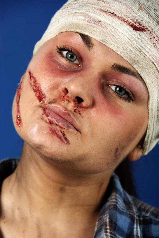 西方人,脸,头,脸颊,一个人,站,竖图,室内,特写,白天,正面,欧洲,欧洲人,仅一个年轻女性,仅一个女性,仅一个人,阴影,蓝色背景,服装,光线,血,影子,注视,休闲装,衣服,观察,看,站着,休闲服,摄影,服饰,影棚,观看,察看,包扎,关注,受伤,年轻女性,女人,女性,白种人,头部,脸部,脸蛋,面部,绷带,站立,半身,彩图,影棚拍摄,拍摄