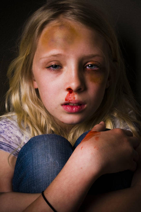 西方人,儿童,一个人,坐,交叉,竖图,室内,白天,正面,纯洁,欧洲,欧洲人,仅一个女性,仅一个人,黑色背景,服装,装饰,头饰,注视,休闲装,小孩,衣服,发饰,饰品,观察,看,仅一个小孩,休闲,休闲服,血液,可爱,童年,童趣,摄影,服饰,影棚,抱膝,观看,悲伤,华丽,修饰,点缀,察看,关注,头绳,童真,烂漫,无邪,配饰,悲哀,衬托,美观,雅致,雅观,悲痛,哀思,悲恸,沉痛,天真,女孩,女人,女性,白种人,孩子,坐着,半身,彩图,影棚拍摄,拍摄,乌青,发绳,女生