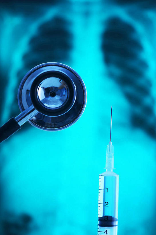 无人,竖图,x光片,室内,特写,白天,正面,静物,阴影,朦胧,模糊,反射,辐射,科学,医学,影子,听诊器,针管,针筒,注射,医疗,医疗设备,注射器,科学技术,x射线,医疗器械,x光,医疗工具,检测工具,彩图,电磁波,电磁辐射