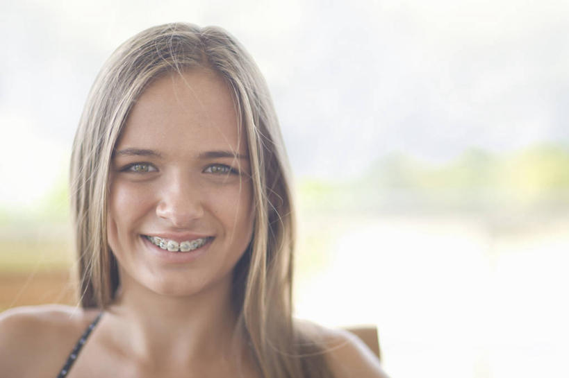 西方人,脸,头,脸颊,头发,一个人,坐,笑,微笑,露齿笑,横图,室外,特写,白天,正面,泳装,比基尼,欧洲,欧洲人,仅一个年轻女性,仅一个女性,仅一个人,阴影,朦胧,模糊,光线,影子,注视,肩膀,阳光,模型,观察,看,金色,模具,观看,察看,关注,矫正,牙科,牙套,牙箍,校正,校准,牙饰,年轻女性,女人,女性,白种人,头部,脸部,脸蛋,面部,坐着,半身,彩图,三点式,泳衣,矫正器