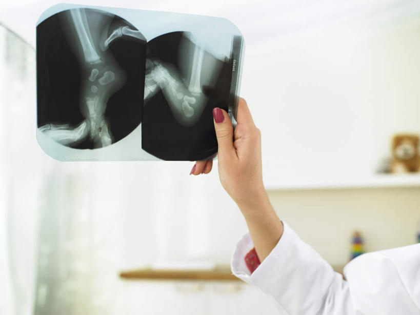 西方人,手,一个人,医生,医院,横图,x光片,室内,特写,白天,正面,工作服,制服,欧洲,欧洲人,仅一个女性,仅一个人,握,朦胧,模糊,辐射,科学,医学,墙,拿,拿着,墙壁,墙面,白色,仅一个中年女性,医护人员,医疗人员,手部,握着,单手,医疗,科学技术,x射线,白大褂,x光,医疗机构,工作制服,女人,女性,中年女性,白种人,大夫,半身,彩图,工作套服,病院,诊所,电磁波,电磁辐射