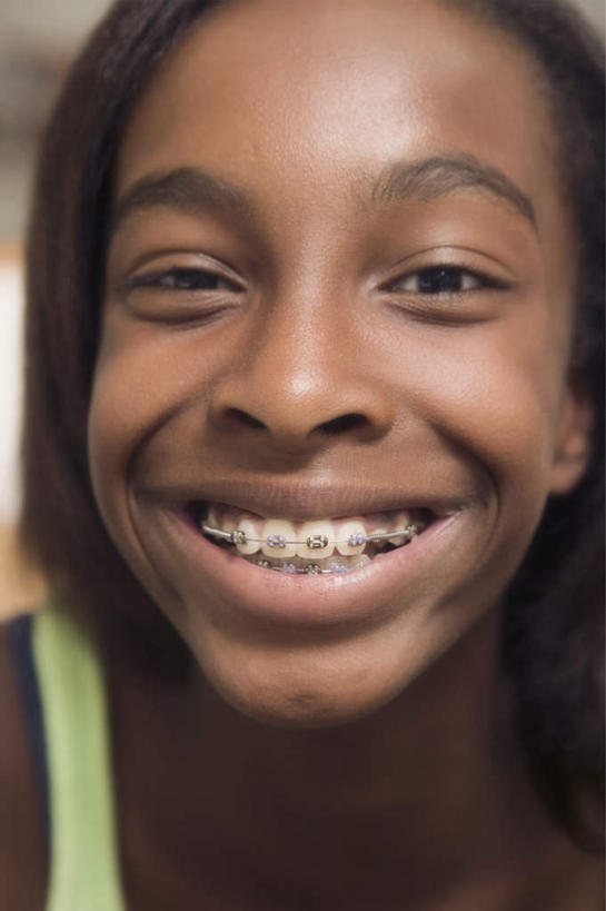 西方人,脸,头,脸颊,头发,一个人,笑,微笑,露齿笑,竖图,室内,特写,白天,正面,欧洲,非洲,黑人,欧洲人,仅一个年轻女性,仅一个女性,仅一个人,服装,背心,注视,衣服,黑色,模型,观察,看,服饰,模具,观看,察看,衣着,穿着,关注,矫正,牙科,牙套,牙箍,校正,校准,牙饰,衣饰,年轻女性,女人,女性,非洲人,头部,直发,脸部,脸蛋,面部,半身,彩图,短发