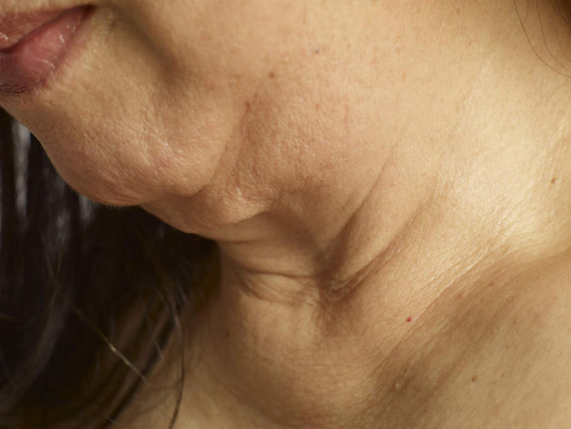 东方人,脸,头,脸颊,脖子,一个人,横图,室内,特写,白天,正面,亚洲,仅一个女性,仅一个人,阴影,反射,影子,黄种人,肩膀,摄影,仅一个老年女性,影棚,老年女性,女人,女性,亚洲人,头部,脖,颈,颈部,脸部,脸蛋,面部,半身,彩图,影棚拍摄,拍摄