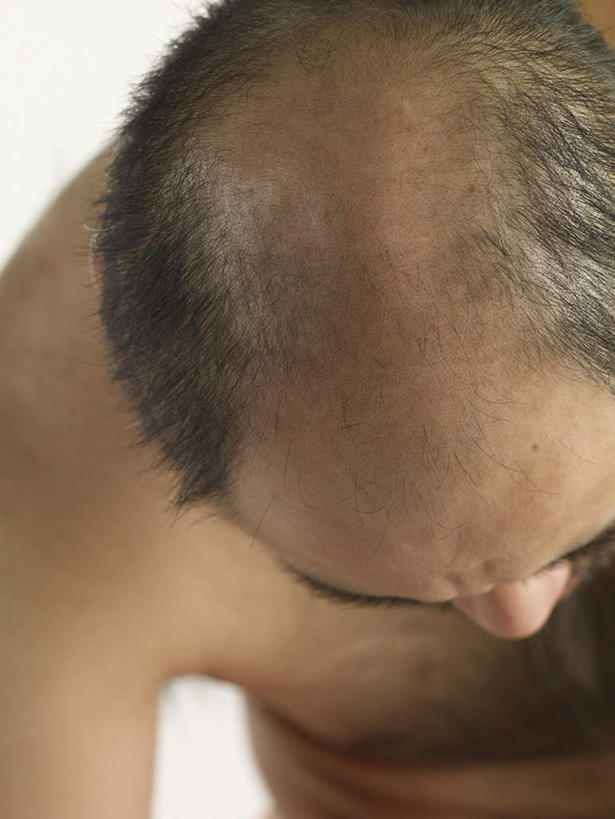 东方人,一个人,竖图,室内,白天,白色背景,正面,亚洲,仅一个男性,仅一个人,仅一个中年男性,弯腰,阴影,朦胧,模糊,反射,影子,黄种人,裸露,低头,摄影,影棚,裸,弯身,垂头,男人,男性,中年男性,亚洲人,半身,彩图,影棚拍摄,拍摄