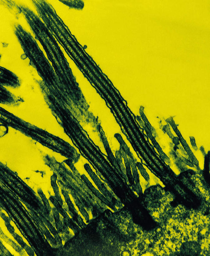 无人,竖图,俯视,室内,特写,白天,仪器,微生物,检查,反射,分析,科学,医学,细胞,显微镜,黄色,绿色,观察,粘液,清晰,探索,放大,观看,仔细,透镜,生物学,凸透镜,聚焦,关注,黏液,神经元,光学,清楚,神经细胞,彩图,高角度拍摄