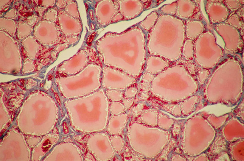 无人,横图,俯视,室内,特写,白天,仪器,微生物,检查,反射,分析,科学,医学,纹路,纹理,细胞,显微镜,红色,观察,清晰,探索,放大,观看,仔细,透镜,生物学,凸透镜,聚焦,关注,神经元,肌理,光学,清楚,神经细胞,彩图,高角度拍摄