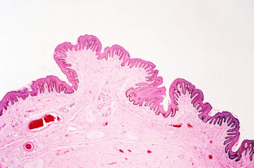 子宫,无人,横图,室内,特写,白天,正面,仪器,微生物,切开,检查,反射,分析,科学,医学,细胞,显微镜,粉色,观察,切,清晰,探索,放大,观看,仔细,透镜,生物学,凸透镜,聚焦,关注,剖面,切面,光学,清楚,显微图片,彩图