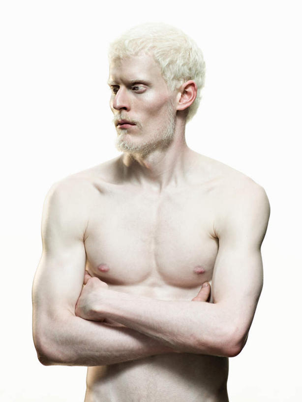 西方人,胡须,一个人,站,双手交叉,竖图,室内,白天,白色背景,正面,欧洲,欧洲人,仅一个男性,仅一个人,扭头,注视,裸露,仅一个年轻男性,观察,看,站着,转头,摄影,影棚,观看,察看,双手抱胸,关注,裸,白化病,男人,男性,年轻男性,白种人,胡子,络腮胡,站立,半身,彩图,影棚拍摄,拍摄