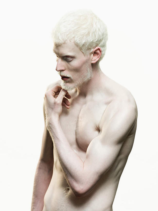 西方人,脸,头,脸颊,脖子,肌肉,健壮,一个人,病人,站,摸,竖图,室内,白天,白色背景,正面,欧洲,欧洲人,仅一个男性,仅一个人,抚摸,注视,裸露,肩膀,仅一个年轻男性,观察,看,站着,健康,活力,力量,摄影,影棚,观看,青春,察看,强壮,关注,裸,白化病,男人,男性,年轻男性,白种人,头部,脖,颈,颈部,脸部,脸蛋,面部,患者,就医者,触摸,接触,站立,半身,彩图,影棚拍摄,拍摄