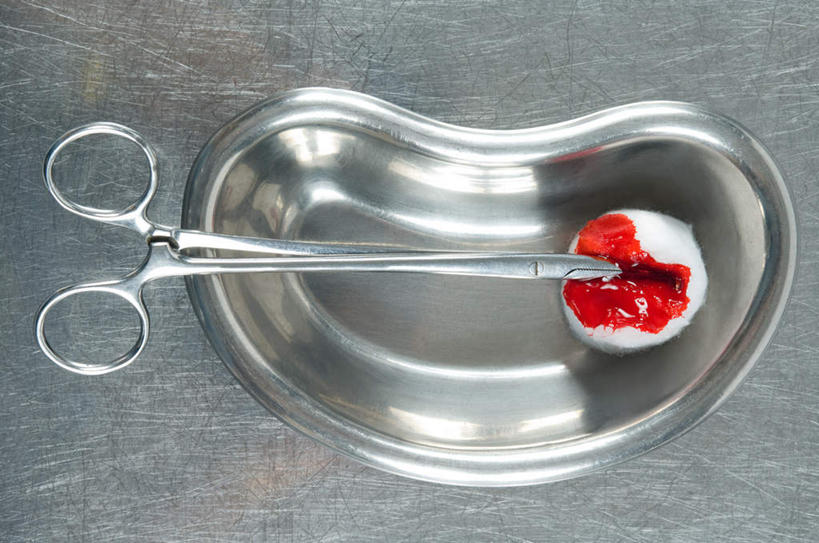 无人,横图,俯视,室内,特写,白天,农作物,餐具,金属制品,一把,修剪,阴影,灰色背景,柔软,反射,金属,碟子,工具,剪刀,盘,液体,影子,棉花,纺织,一个,盘子,碟,健康,温暖,棉花球,血液,摄影,影棚,单个,裁剪,纤维,剪子,剪裁,切割,柔和,手术剪刀,手术剪,暖和,彩图,高角度拍摄,影棚拍摄,拍摄