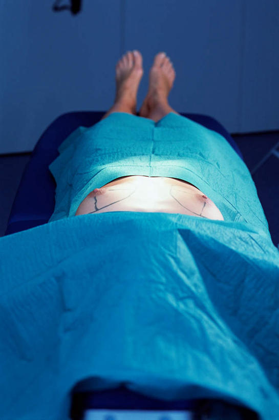 西方人,乳房,一个人,医院,躺,竖图,俯视,室内,白天,绘画,床,欧洲,欧洲人,仅一个年轻女性,仅一个女性,仅一个人,阴影,反射,圆形,影子,墙,床单,被子,裸露,墙壁,墙面,单人床,手术室,被单,裸,整容,医疗机构,隆胸,卧着,年轻女性,女人,女性,白种人,躺着,卧,半身,彩图,高角度拍摄,病院,诊所