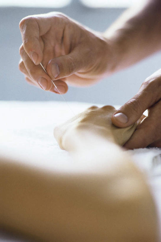 西方人,手,背部,两个人,竖图,室内,白天,侧面,桌子,欧洲,欧洲人,握,服装,拿,拿着,休闲装,文化,针,衣服,休闲,手部,休闲服,握着,保健,服饰,医疗,穴位,针灸,中医,穴道,男人,男性,年轻男性,年轻女性,女人,女性,白种人,半身,彩图,传统文化