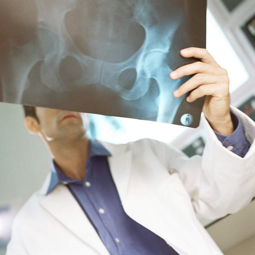 西方人,脸,脸颊,一个人,医生,办公室,医院,方图,x光片,室内,白天,仰视,仪器,欧洲,欧洲人,仅一个男性,仅一个人,仅一个中年男性,两张,握,挂,拿,拿着,注视,观察,看,医护人员,医疗人员,握着,遮,遮掩,观看,察看,医疗设备,掩盖,遮挡,挂着,白大褂,关注,医疗器械,医疗仪器,遮盖,医疗机构,掩饰,观片灯,男人,男性,中年男性,白种人,脸部,脸蛋,面部,大夫,半身,彩图,低角度拍摄,病院,诊所