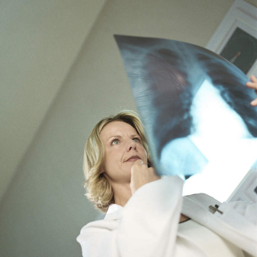 西方人,一个人,医生,办公室,医院,方图,x光片,室内,白天,仰视,仪器,欧洲,欧洲人,仅一个女性,仅一个人,两张,握,挂,拿,拿着,注视,观察,看,仅一个中年女性,医护人员,医疗人员,握着,观看,察看,医疗设备,挂着,白大褂,关注,医疗器械,医疗仪器,医疗机构,观片灯,女人,女性,中年女性,白种人,大夫,半身,彩图,低角度拍摄,病院,诊所