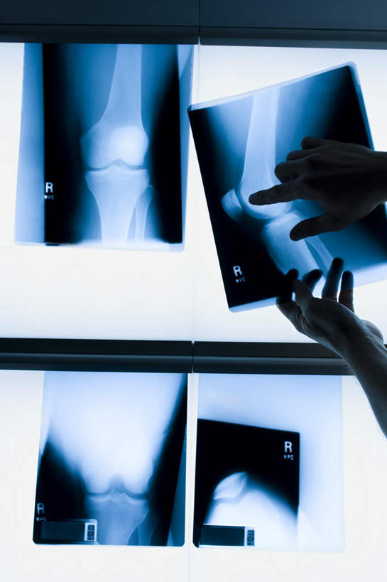 西方人,手,骨骼,一个人,医生,医院,竖图,x光片,室内,特写,白天,正面,欧洲,欧洲人,双手,仅一个男性,仅一个人,仅一个中年男性,握,指,检查,辐射,科学,医学,墙,骨头,背光,拿,拿着,指点,墙壁,墙面,蓝色,黑色,观察,医护人员,医疗人员,手部,握着,灯箱,骨架,医疗,医疗设备,科学技术,x射线,指向,医疗器械,x光,逆光,医疗机构,看片灯箱,男人,男性,中年男性,白种人,大夫,半身,彩图,病院,诊所,电磁波,电磁辐射